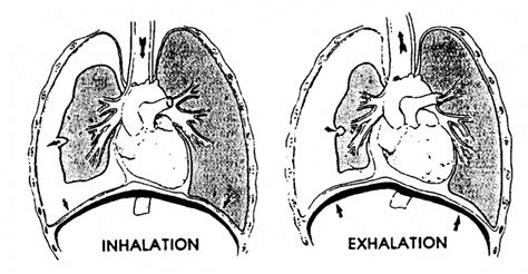 chest compression test trauma|tension pneumothorax chest trauma.